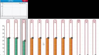 Measuring eSRT for MedEL cochlear Implants [upl. by Krisha]