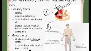 ipsilateral contralateral [upl. by Eleph]