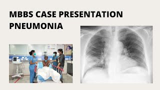 MBBS Case Presentation  Pneumonia [upl. by Kurman]