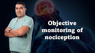 Objective monitoring of nociception [upl. by Evania]