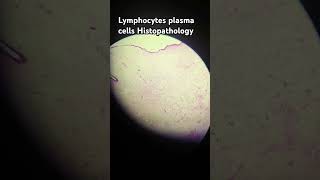 lymphocytes  plasma cells [upl. by Araf]