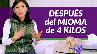 Mi vida tras quitarme un mioma de 4 kilos [upl. by Eillo]