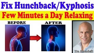 Fix HunchbackKyphosis in Just a Few Minutes a Day While Relaxing  Dr Alan Mandell DC [upl. by Maker]