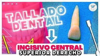 TALLADO del INCISIVO CENTRAL SUPERIOR DERECHO 4 FASES [upl. by Animrac]