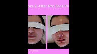 DERMALOGICA FACE PEEL [upl. by Airalav]