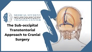 The Suboccipital Transtentorial Approach to Cranial Surgery [upl. by Rabah]