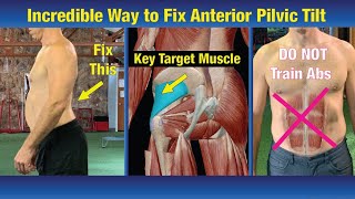 How to correct anterior pelvic tilt in home tamil homeworkout tamilfitnesschannel tamilworkout [upl. by Brear]