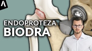 Endoproteza stawu biodrowego I Czy jest KONIECZNA dla Twoich bioder I Fizjomate [upl. by Beaufert]