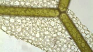 Hydrodictyon a netlike green alga [upl. by Binnings229]