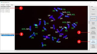 Karyotype analysis using KaryoMeasure [upl. by Hinch]