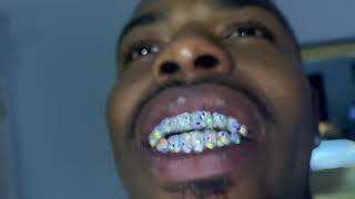 VVS Diamond Grillz In 14KT Yellow Gold amp White Gold [upl. by Arte424]