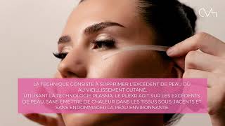 LA BLÉPHAROPLASTIE MÉDICALE PAR PLEX’R  Victoire Haussmann Paris [upl. by Novyad]