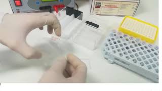 Hemoglobin electrophoresis procedure [upl. by Oirad]