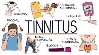 Understanding the Causes of Tinnitus [upl. by Whorton258]