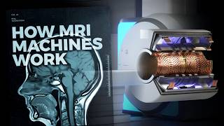 The Insane Engineering of MRI Machines [upl. by Aliakam115]