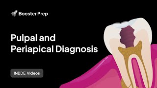 Pulpal and Periapical Diagnoses 2024 INBDE NDEB ADAT [upl. by Marius]