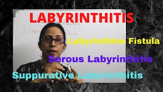 055 Labyrinthitis otitismedia vertigo [upl. by Alfreda537]