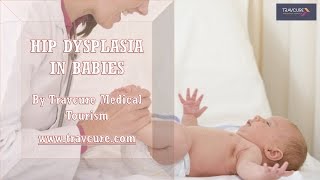 How to Identify Hip Dysplasia in Infants [upl. by Assillim576]