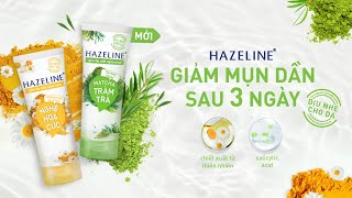 Hazeline  Giảm mụn dần sau 3 ngày  Dòng sản phẩm cho da dầu mụn và da nhạy cảm [upl. by Nitreb]