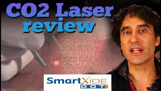 CO2 LASER REVIEW  Glass Skin [upl. by Grant]