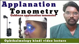 Goldmann Applanation Tonometry [upl. by Nagorb]