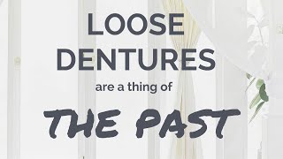 LOOSE DENTURES are a thing OF THE PAST [upl. by Rockefeller]