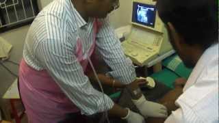 intussusception by Dr K M Abul Hasan [upl. by Eudo712]