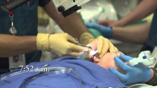 Complete Ear Tube Surgery [upl. by Hilten]