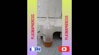 PLASMAPHERESIS THERAPY DIALYSIS MACHINE [upl. by Anerres]