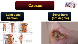 Pathology 3D  Circulation  Embolism [upl. by Sullecram]