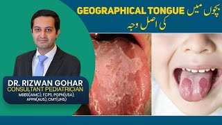 Treatment of Geographic Tongue👅😛 geographic tongue treatment [upl. by Anirbas]