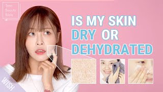 You Have Dry Skin amp ACNE Best Skincare for Dry vs Dehydrated Skin l You Need to See This [upl. by Yelich239]