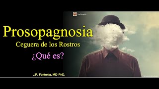 Ceguera de los Rostros Prosopagnosia ¿Qué es [upl. by Fairleigh]