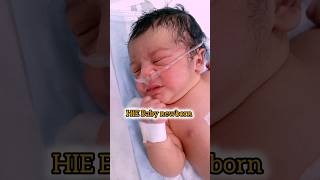 infant Baby Care newborn nicu 💉🥼🥀 youtubeshorts short cutebaby babygirl [upl. by Elak]