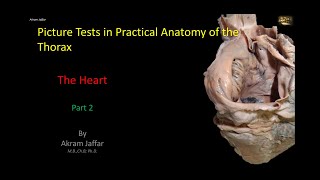 Picture Tests in Anatomy  Thorax  Heart 2 [upl. by Delilah]