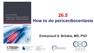 265 Manual of PCI  Pericardiocentesis [upl. by Bradan]