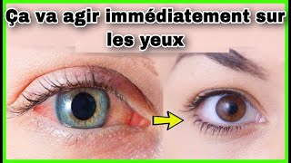 Existetil un remède contre les tâches dans les yeux [upl. by Ykcul]