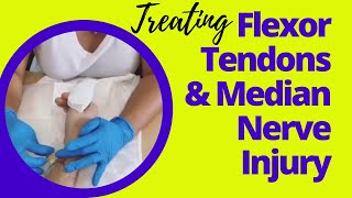 Treating A Hand Injury Flexor Tendons amp The Median Nerve  Hand Therapy Secrets [upl. by Boggers89]