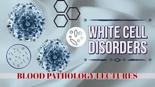 WHITE CELLS DISORDERS lecture 5 LYMPHOID NEOPLASMS some basic rules to follow [upl. by Maryly]