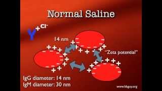 Pretransfusion Testing [upl. by Ilagam]