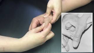 Special test  Thumb Ulnar Collateral Ligament Instability test [upl. by Caroline]