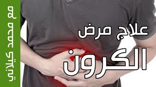 علاج مرض الكرون في 5 أسابيع  Crohn Disease [upl. by Nylrehc]