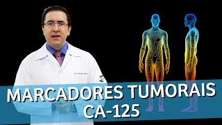 CA 125 Marcador Tumoral  O que significa este marcador tumoral CA125  IMEB [upl. by Matheson]