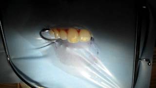 Tooth Stain Removal  Opalustre Part 1 [upl. by Galligan]