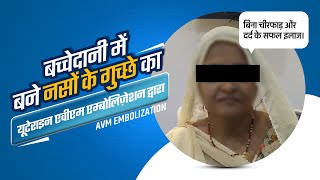 Uterine AVM Embolization Treatment  Patient Testimonial Uterine Arteriovenous Malformation AVM [upl. by Zolnay]