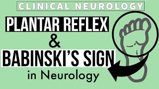 PLANTAR REFLEX  BABINSKIs SIGN  Equivocal Plantar  Other methods  Clinical Neurology [upl. by Hebner866]