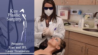 Frax amp IPL Laser Treatments [upl. by Alidis]