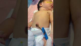 3 days of umbilical cord😱😱newbornbaby babynewbornhospital [upl. by Enovaj]