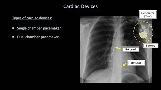 How to Interpret a Chest XRay Lesson 9  Atelectasis Lines Tubes Devices and Surgeries [upl. by Hartzke]