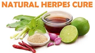 Herpes Cure  Natural Home Remedies For Herpes [upl. by Louis]